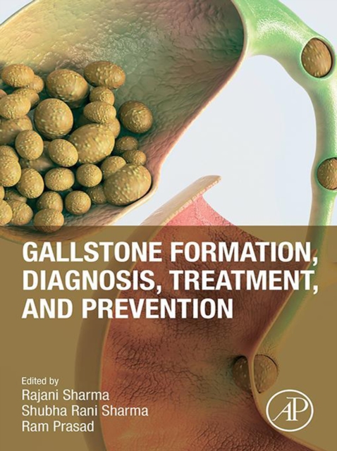 Gallstone Formation, Diagnosis, Treatment and Prevention, EPUB eBook