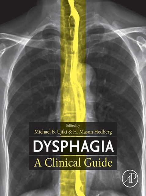 Dysphagia : A Clinical Guide, EPUB eBook