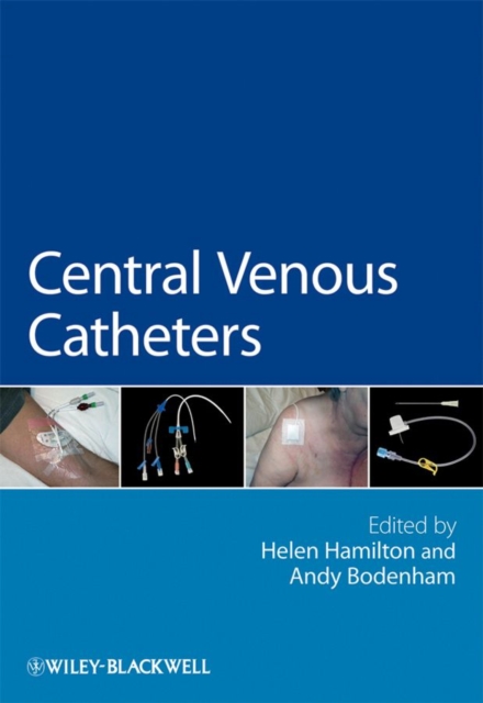Central Venous Catheters, PDF eBook