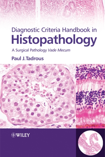 Diagnostic Criteria Handbook in Histopathology : A Surgical Pathology Vade Mecum, Hardback Book