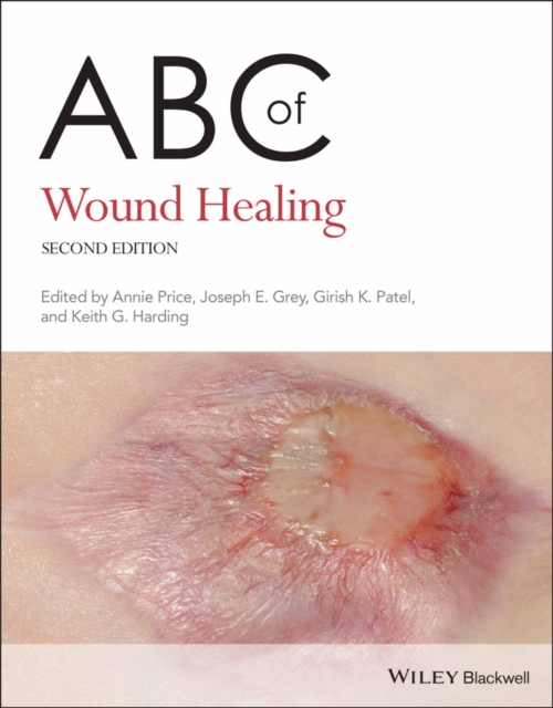 ABC of Wound Healing, Paperback / softback Book