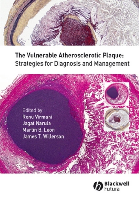 The Vulnerable Atherosclerotic Plaque : Strategies for Diagnosis and Management, PDF eBook