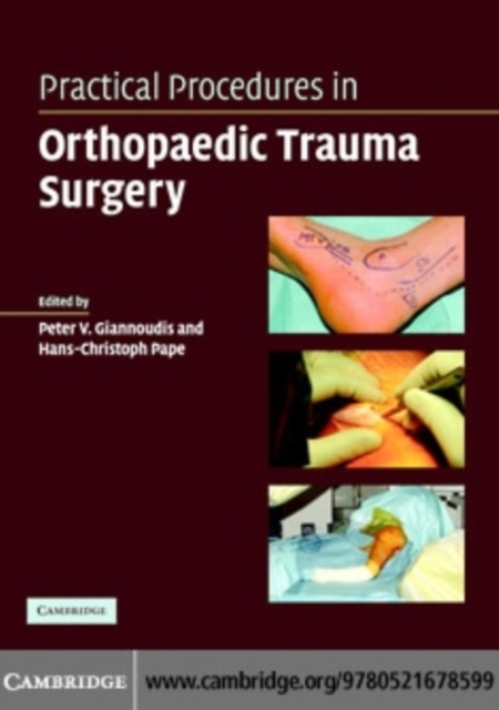 Practical Procedures in Orthopaedic Trauma Surgery, PDF eBook