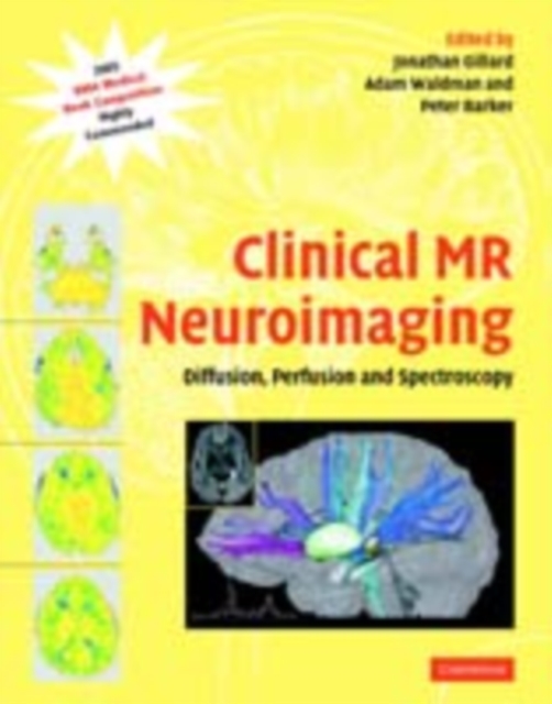Clinical MR Neuroimaging : Diffusion, Perfusion and Spectroscopy, PDF eBook
