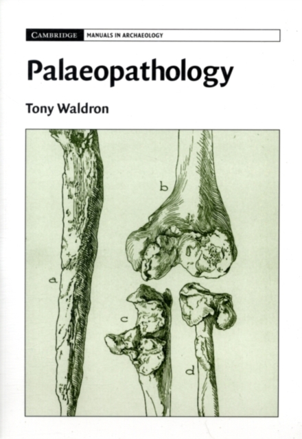 Palaeopathology, PDF eBook