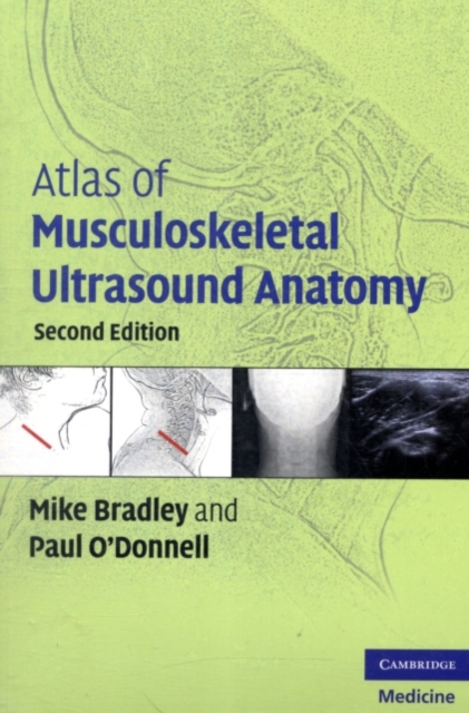 Atlas of Musculoskeletal Ultrasound Anatomy, PDF eBook