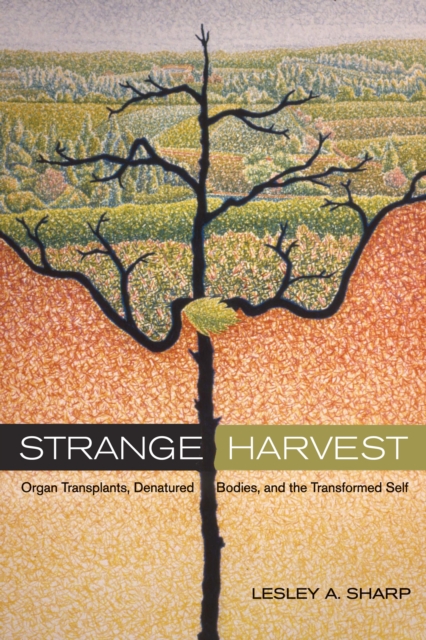 Strange Harvest : Organ Transplants, Denatured Bodies, and the Transformed Self, EPUB eBook