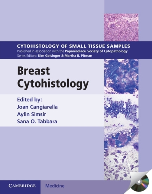 Breast Cytohistology with DVD-ROM, Mixed media product Book