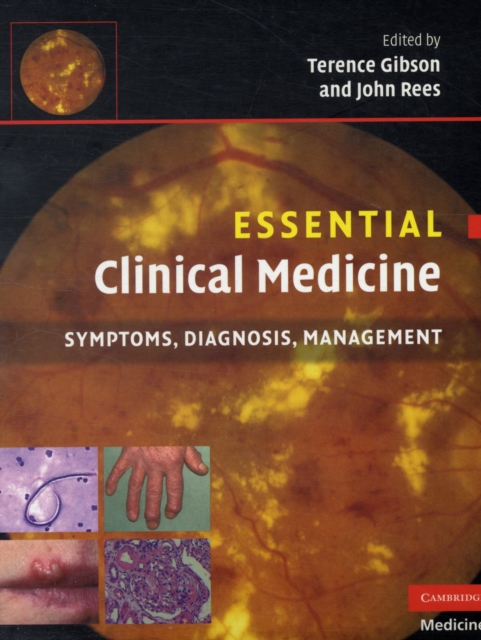 Essential Clinical Medicine : Symptoms, Diagnosis, Management, Paperback / softback Book