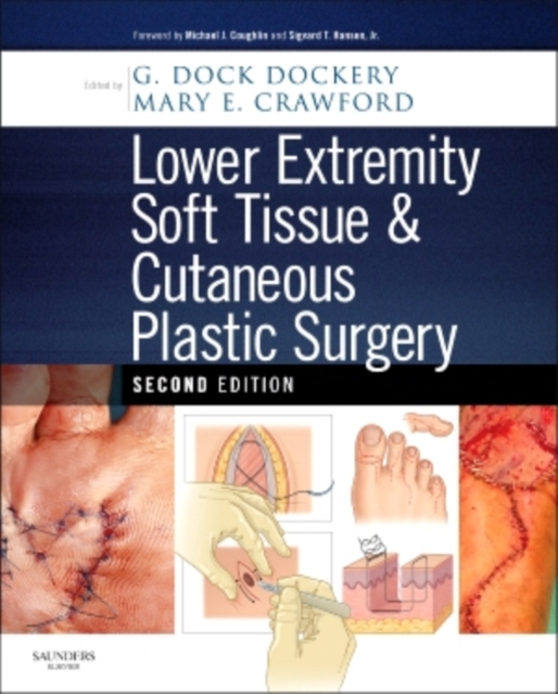 Lower Extremity Soft Tissue & Cutaneous Plastic Surgery, Hardback Book