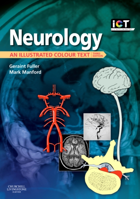 Neurology : An Illustrated Colour Text, Paperback / softback Book