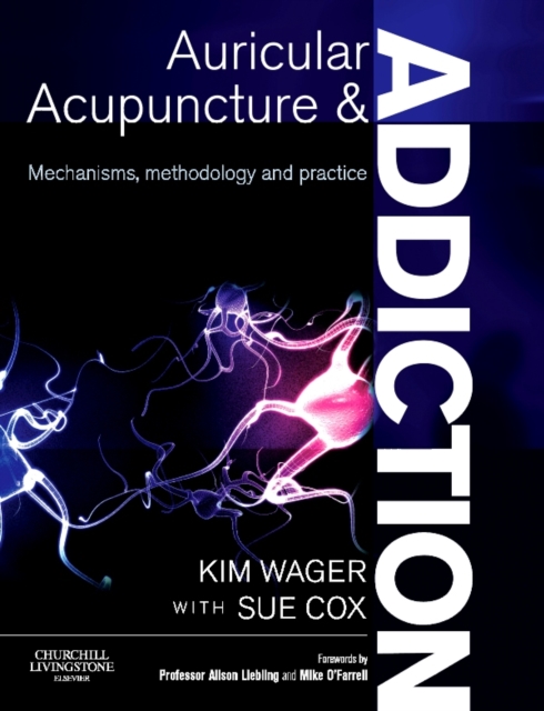 Auricular Acupuncture and Addiction E-Book : Auricular Acupuncture and Addiction E-Book, PDF eBook