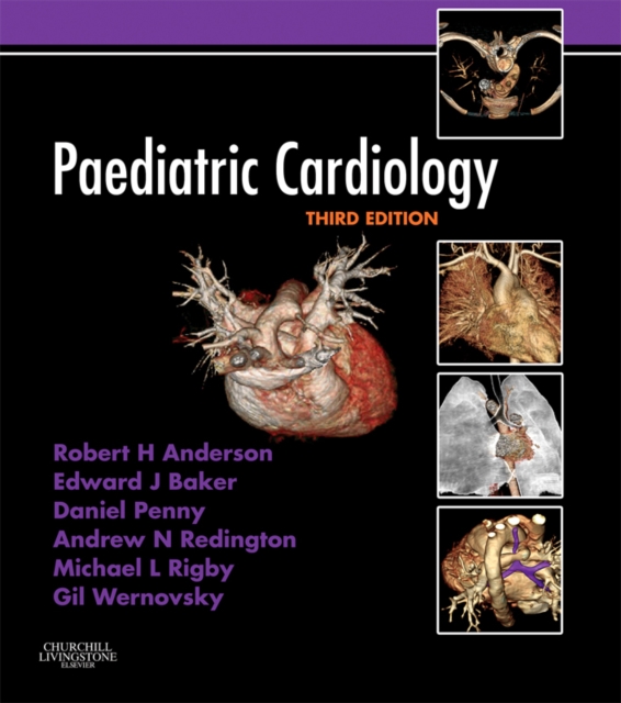 Paediatric Cardiology, EPUB eBook