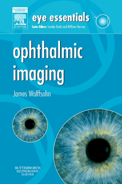 Eye Essentials: Ophthalmic Imaging E-Book, PDF eBook