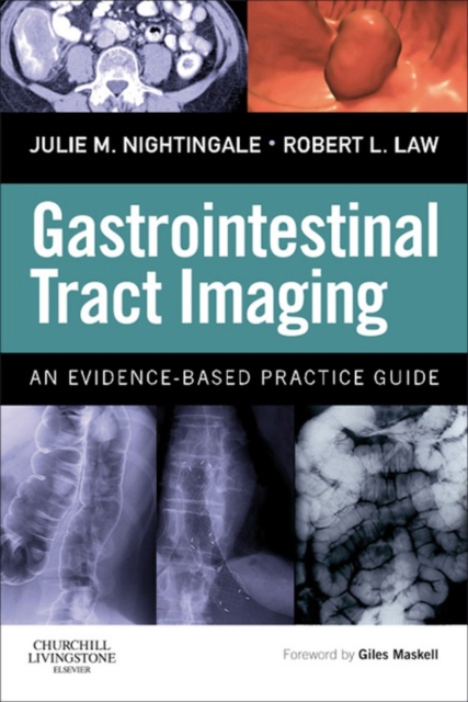 Gastrointestinal Tract Imaging E-Book : Gastrointestinal Tract Imaging E-Book, EPUB eBook