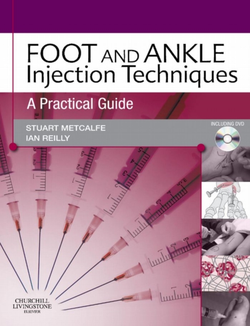 Foot and Ankle Injection Techniques : A Practical Guide, PDF eBook
