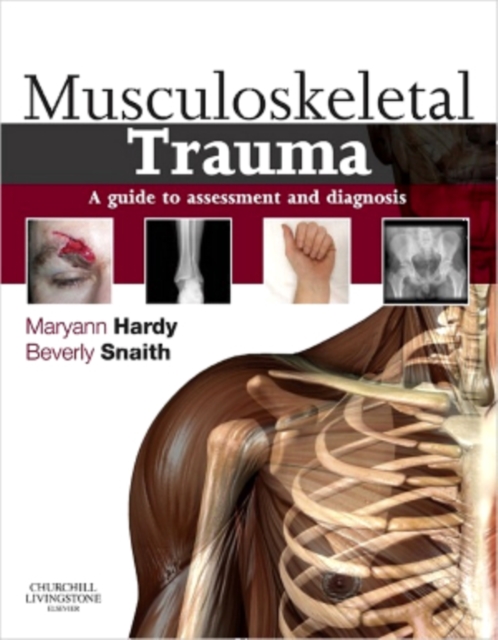 Musculoskeletal Trauma E-Book : Musculoskeletal Trauma E-Book, EPUB eBook