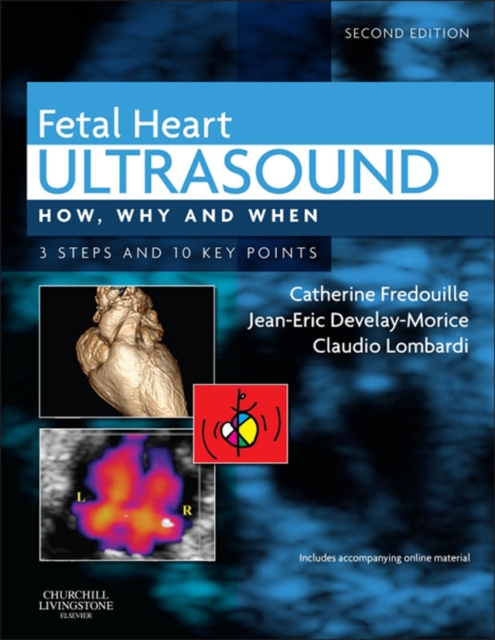 Fetal Heart Ultrasound - E-Book : Fetal Heart Ultrasound - E-Book, EPUB eBook