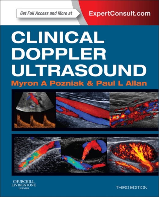 Clinical Doppler Ultrasound E-Book : Expert Consult: Online, EPUB eBook