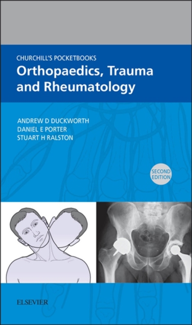 Churchill's Pocketbook of Orthopaedics, Trauma and Rheumatology - E-Book : Churchill's Pocketbook of Orthopaedics, Trauma and Rheumatology - E-Book, EPUB eBook