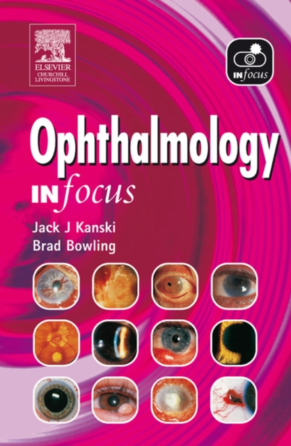Ophthalmology In Focus, EPUB eBook