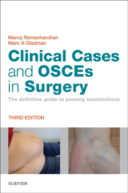 Clinical Cases and OSCEs in Surgery E-Book : Clinical Cases and OSCEs in Surgery E-Book, EPUB eBook