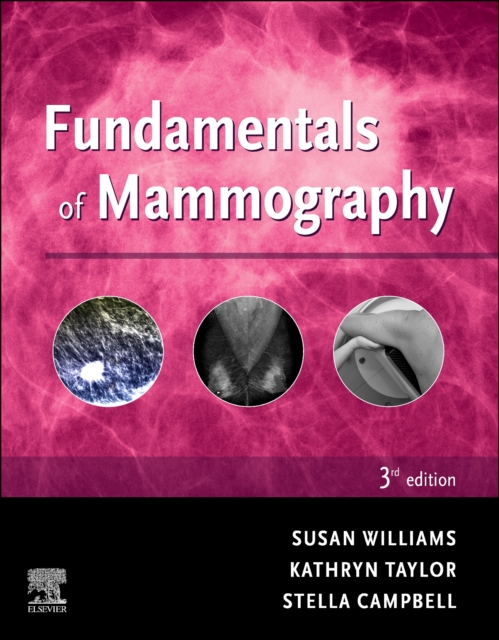 Fundamentals of Mammography, Paperback / softback Book