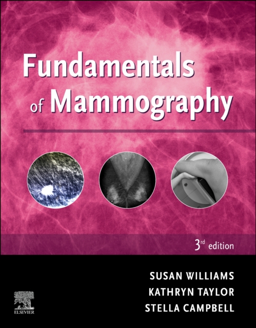 Fundamentals of Mammography - E-Book, EPUB eBook