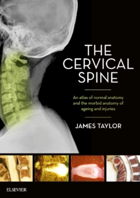 The Cervical Spine : An atlas of normal anatomy and the morbid anatomy of ageing and injuries, Paperback / softback Book