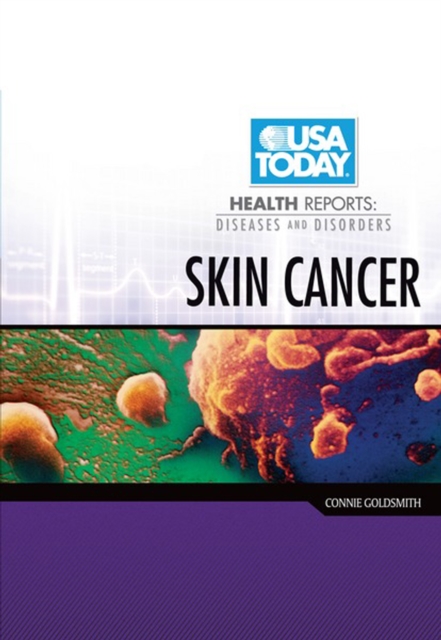 Skin Cancer, PDF eBook