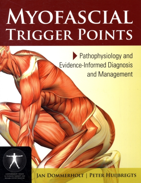 Myofascial Trigger Points: Pathophysiology And Evidence-Informed Diagnosis And Management, Paperback / softback Book