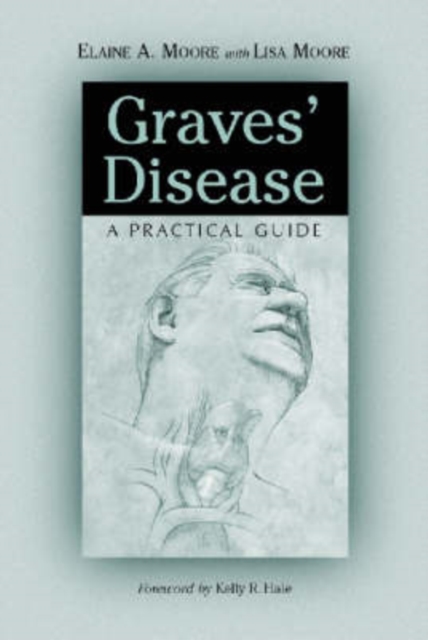 Graves' Disease : A Practical Guide, Paperback / softback Book