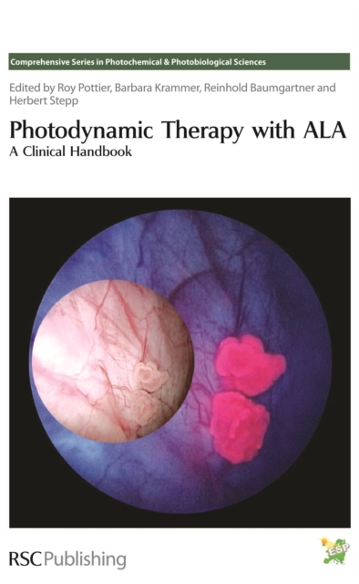 Photodynamic Therapy with ALA : A Clinical Handbook, Hardback Book