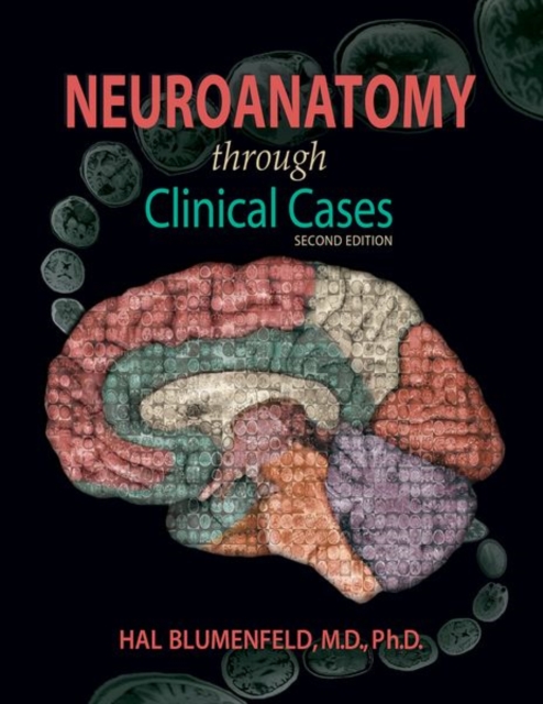 Neuroanatomy through Clinical Cases, Paperback / softback Book