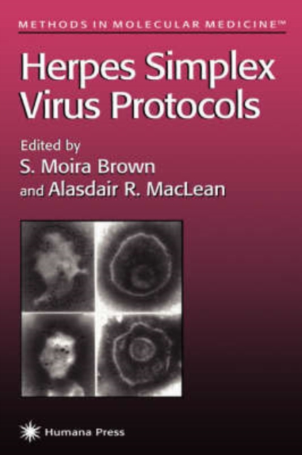 Herpes Simplex Virus Protocols, Hardback Book