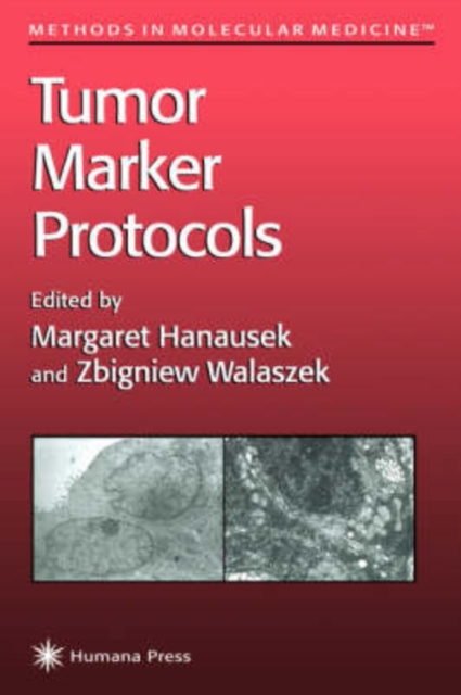 Tumor Marker Protocols, Hardback Book