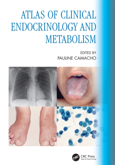 Atlas of Clinical Endocrinology and Metabolism, PDF eBook