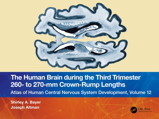 The Human Brain during the Third Trimester 260- to 270-mm Crown-Rump Lengths : Atlas of Central Nervous System Development, Volume 12, EPUB eBook