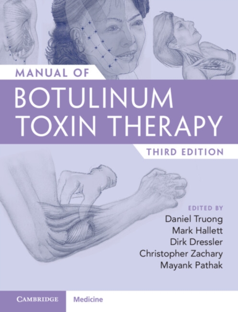 Manual of Botulinum Toxin Therapy, Hardback Book