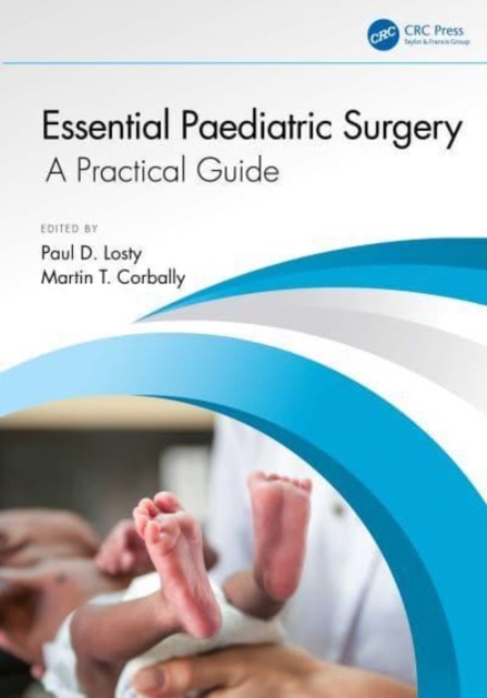 Essential Paediatric Surgery : A Practical Guide, Paperback / softback Book