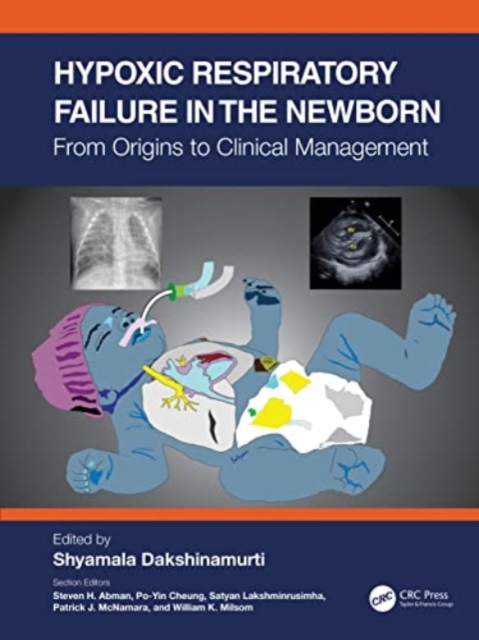 Hypoxic Respiratory Failure in the Newborn : From Origins to Clinical Management, Paperback / softback Book