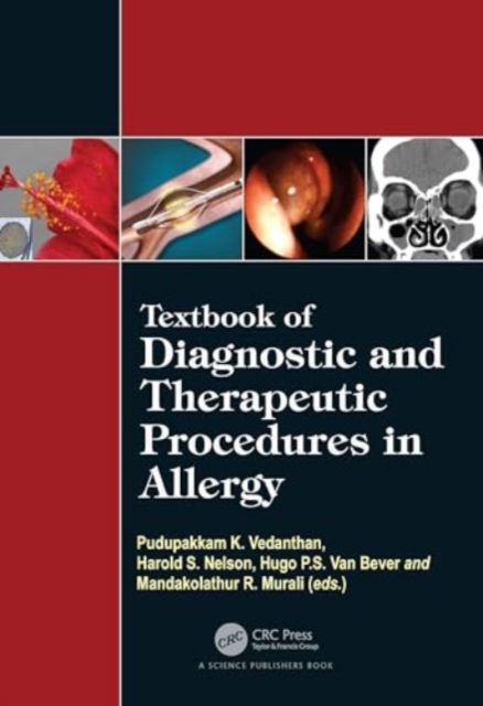 Textbook of Diagnostic and Therapeutic Procedures in Allergy, Hardback Book