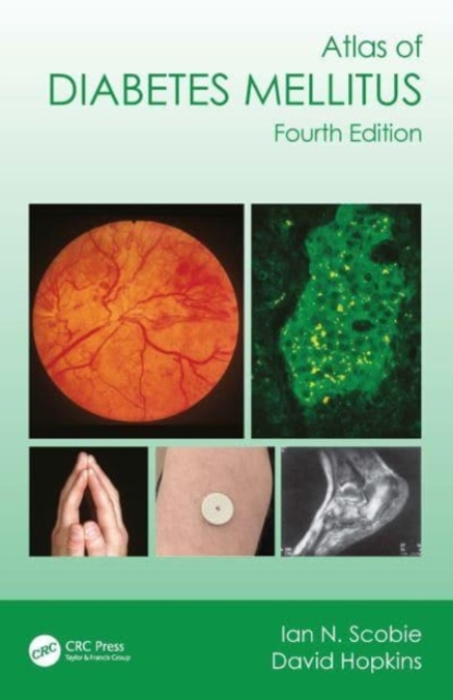Atlas of Diabetes Mellitus, Paperback / softback Book