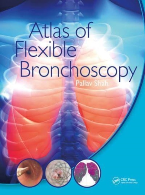 Atlas of Flexible Bronchoscopy, Paperback / softback Book