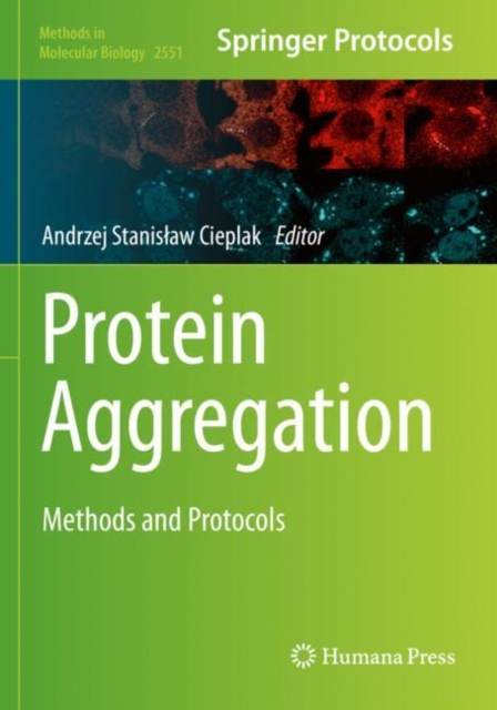 Protein Aggregation : Methods and Protocols, Paperback / softback Book