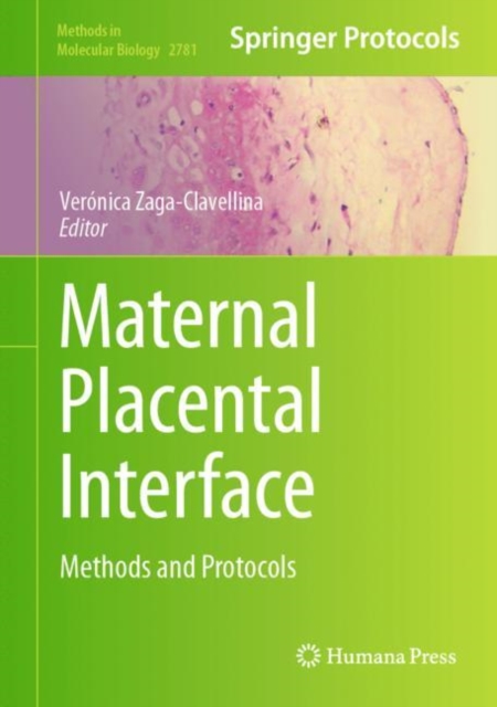 Maternal Placental Interface : Methods and Protocols, EPUB eBook