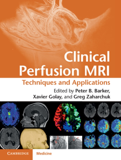 Clinical Perfusion MRI : Techniques and Applications, PDF eBook