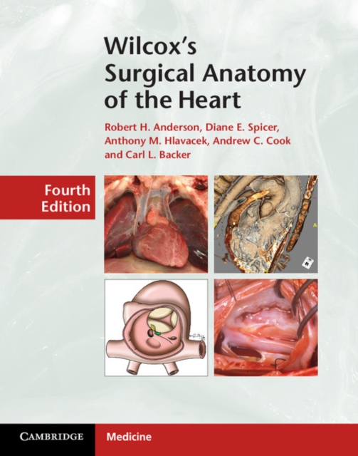 Wilcox's Surgical Anatomy of the Heart, EPUB eBook