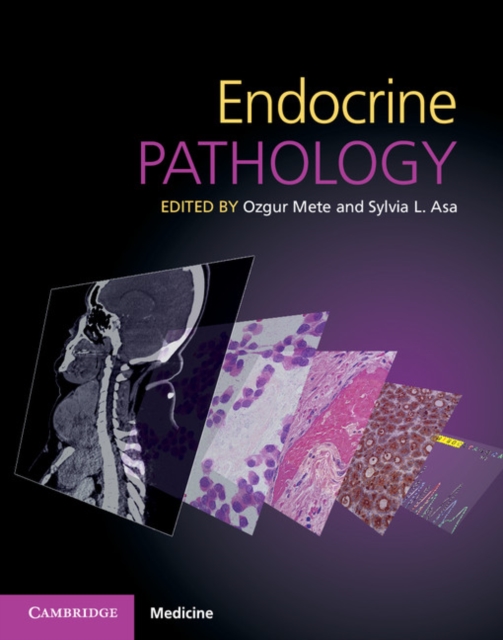 Endocrine Pathology with Online Resource, Mixed media product Book