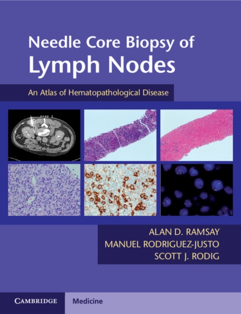 Needle Core Biopsy of Lymph Nodes with DVD-ROM : An Atlas of Hematopathological Disease, Mixed media product Book